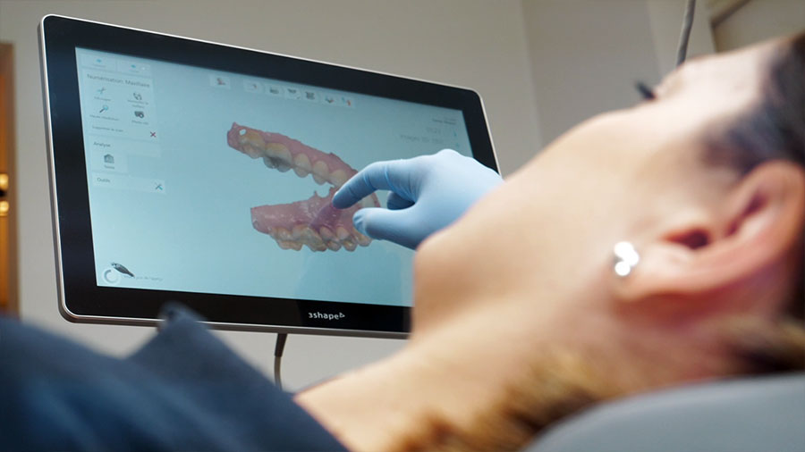 modélisation numérique 3D de la dentition